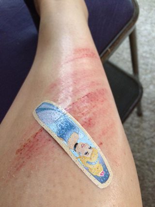 CrashBandaid